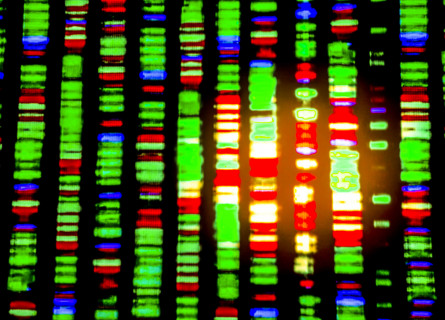 A DNA array with stripes of shining green, blue and red bubbles.