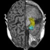 Previous article